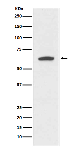 Cytokeratin 9 Rabbit mAb ABZ5221