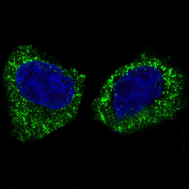 IKK beta Rabbit mAb ABZ5222