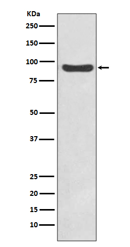 IKK beta Rabbit mAb ABZ5222