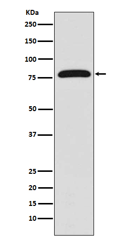 Transglutaminase 2 Rabbit mAb ABZ5224