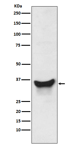 BNIP3L Rabbit mAb ABZ5225