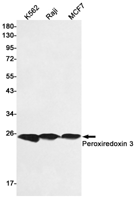 Peroxiredoxin 3/PRDX3 Rabbit mAb ABZ5226