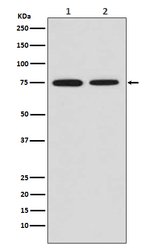 CD204 Rabbit mAb ABZ5227