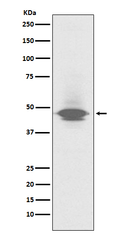 CD79a Rabbit mAb ABZ5228
