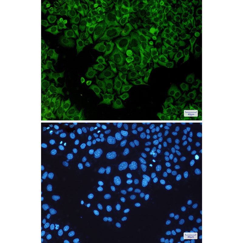 TNF Receptor 2 Rabbit mAb ABZ5230