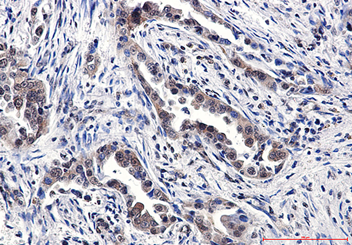 TNF Receptor 2 Rabbit mAb ABZ5230