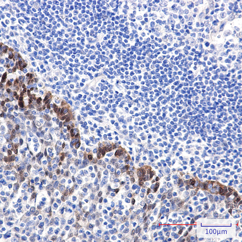 Hsp70 Rabbit mAb ABZ5233
