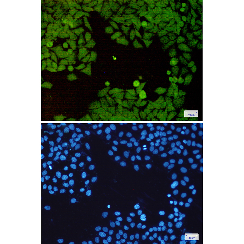 PSMD14 Rabbit mAb ABZ5235