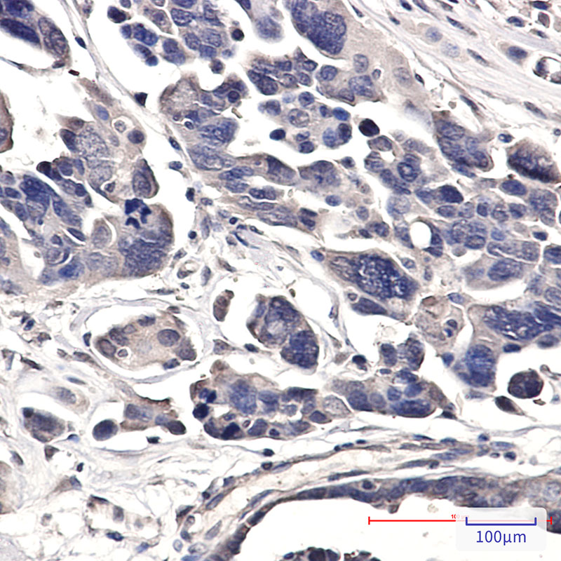 PSMD14 Rabbit mAb ABZ5235