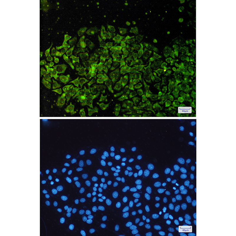 NSE Rabbit mAb ABZ5236