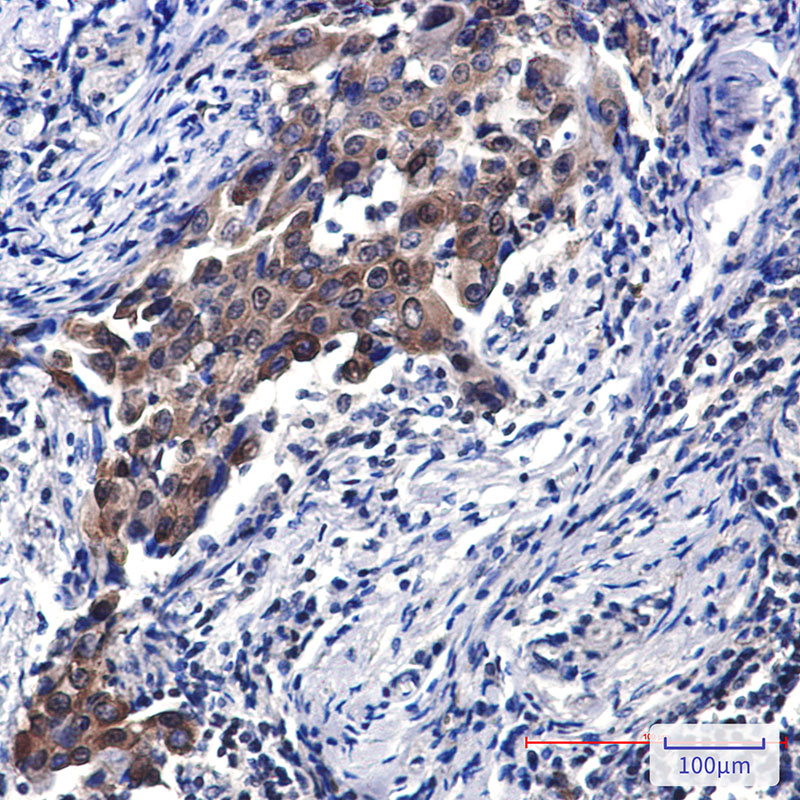NSE Rabbit mAb ABZ5236