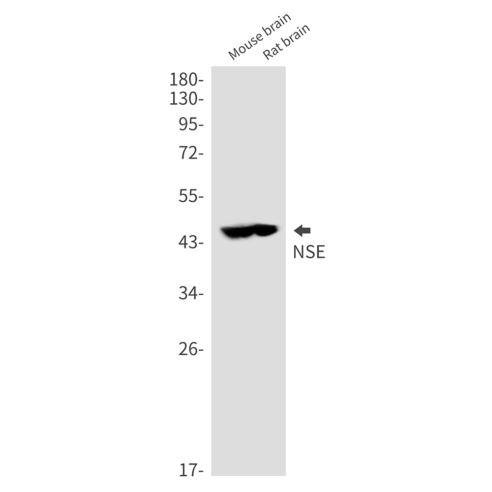 NSE Rabbit mAb ABZ5236