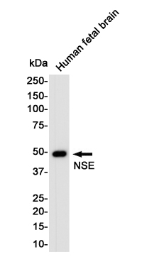 NSE Rabbit mAb ABZ5236