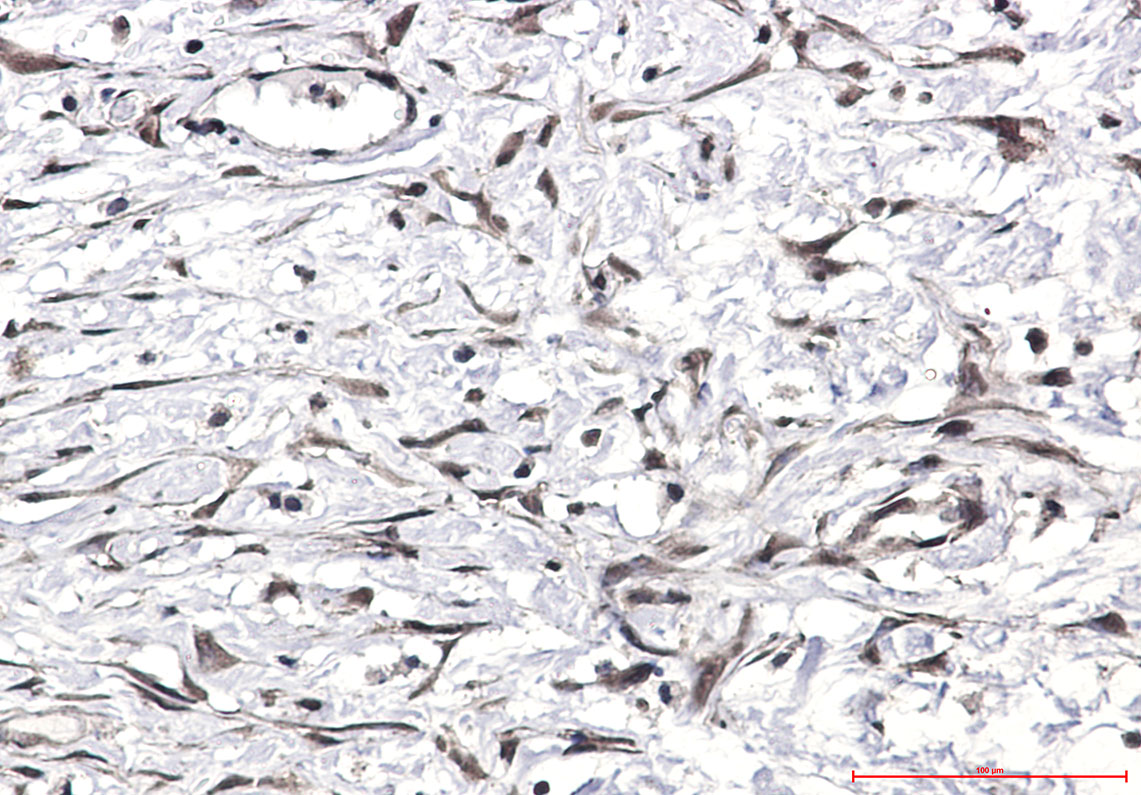 Ubiquitin Rabbit mAb ABZ5237
