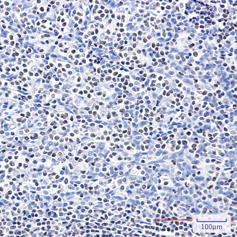 IKZF3 Rabbit mAb ABZ5238