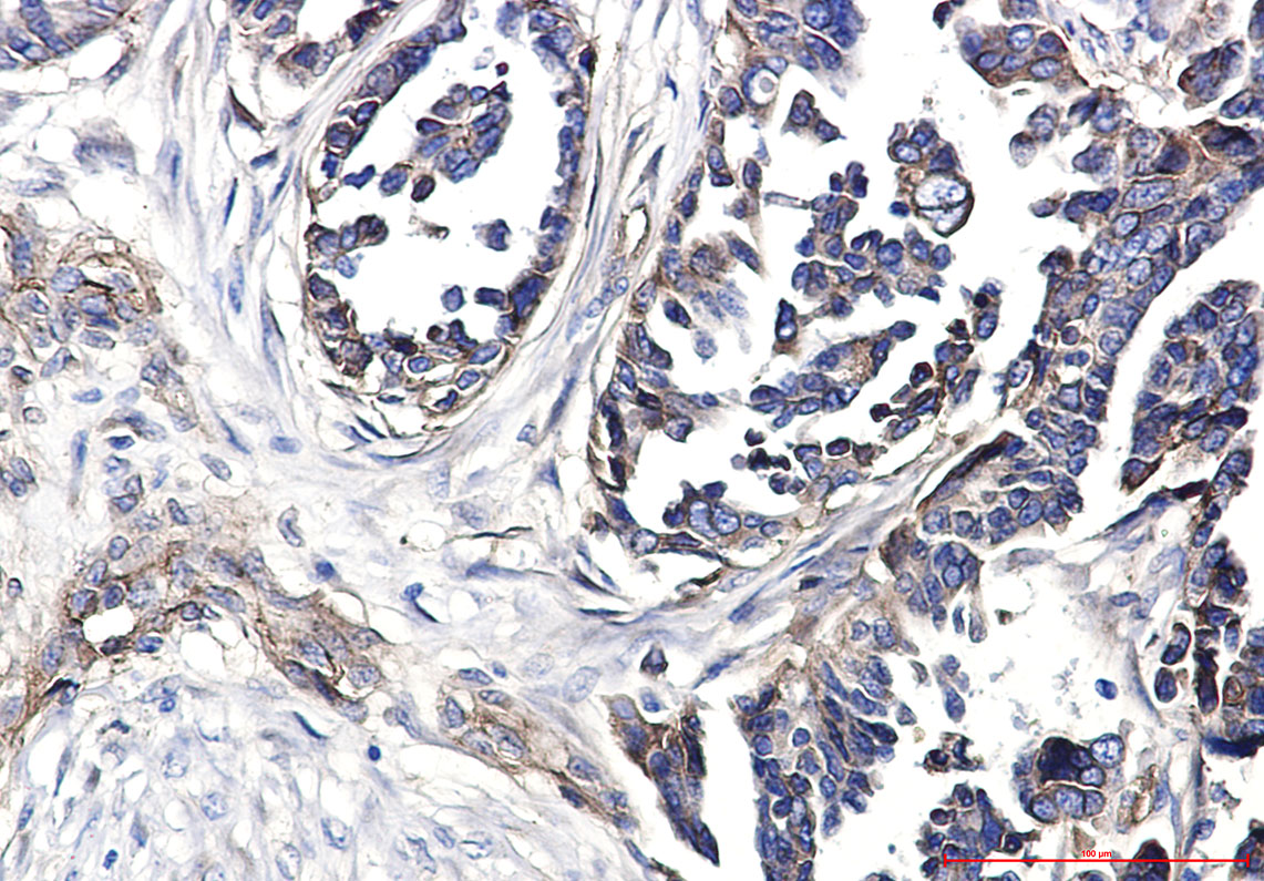 Integrin beta 1 Rabbit mAb ABZ5239