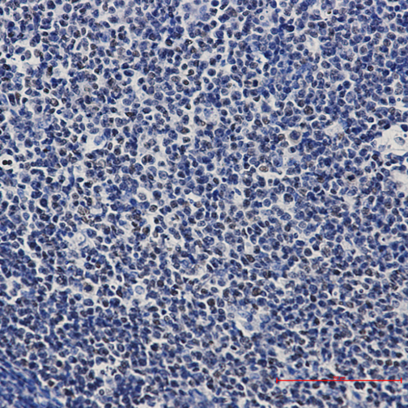 PARP1 Rabbit mAb ABZ5240