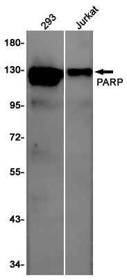 PARP1 Rabbit mAb ABZ5240