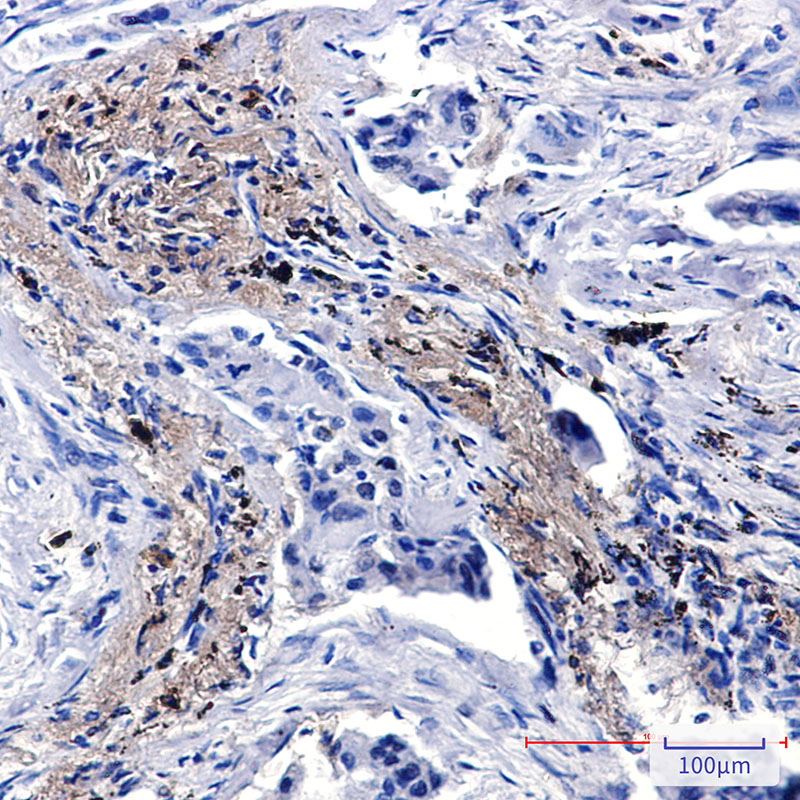 Lysozyme Rabbit mAb ABZ5241