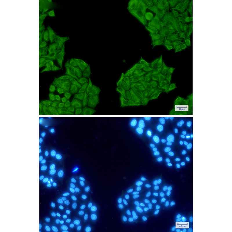 Cytokeratin 8 Rabbit mAb ABZ5242