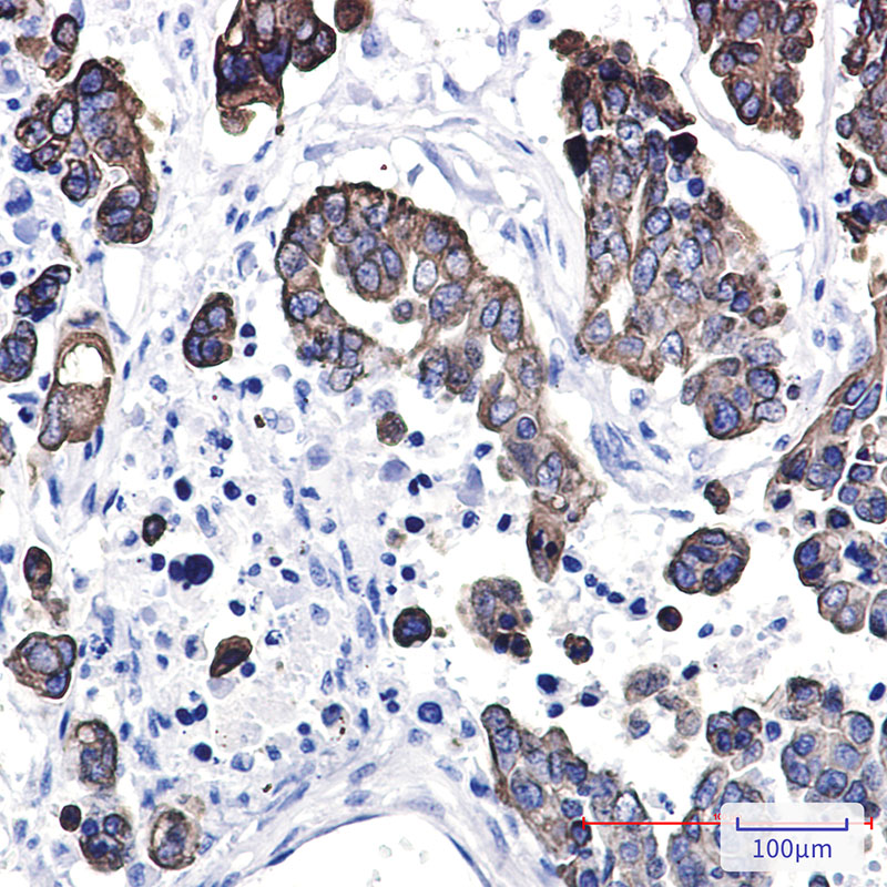 Cytokeratin 8 Rabbit mAb ABZ5242