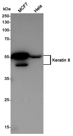 Cytokeratin 8 Rabbit mAb ABZ5242