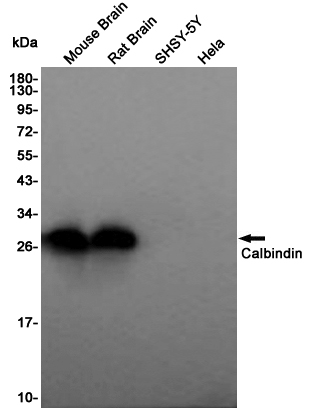 Calbindin Rabbit mAb ABZ5243