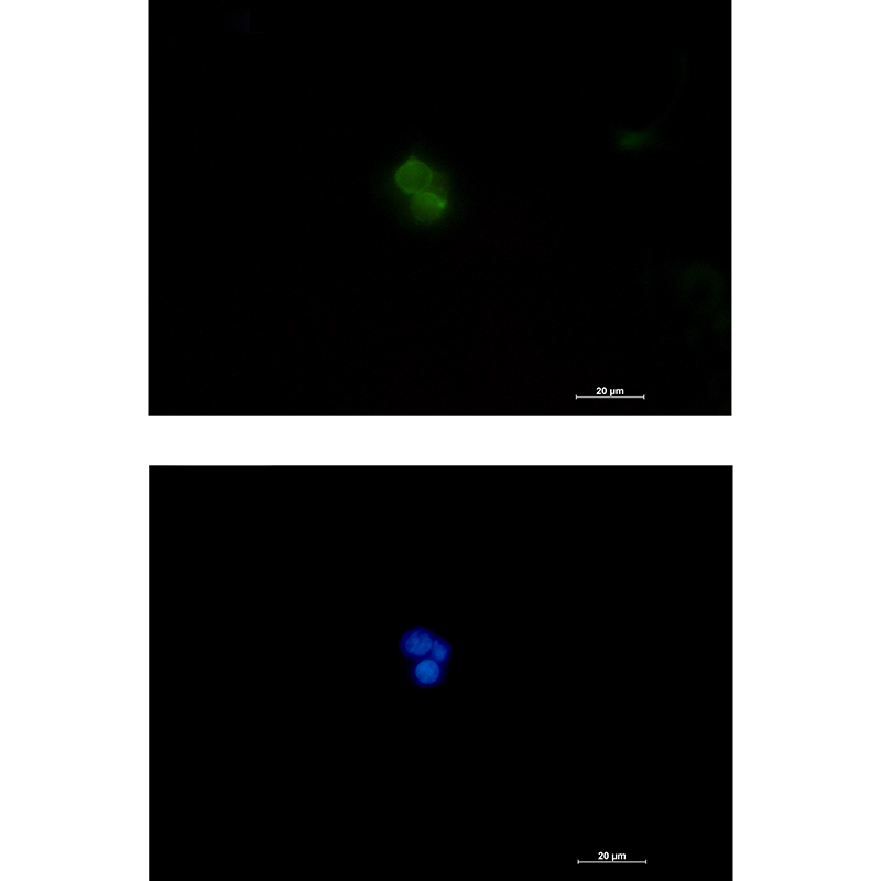 Plastin L Rabbit mAb ABZ5244