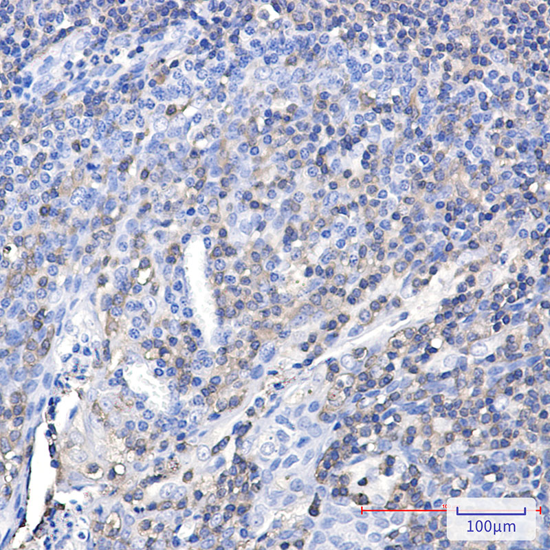Plastin L Rabbit mAb ABZ5244