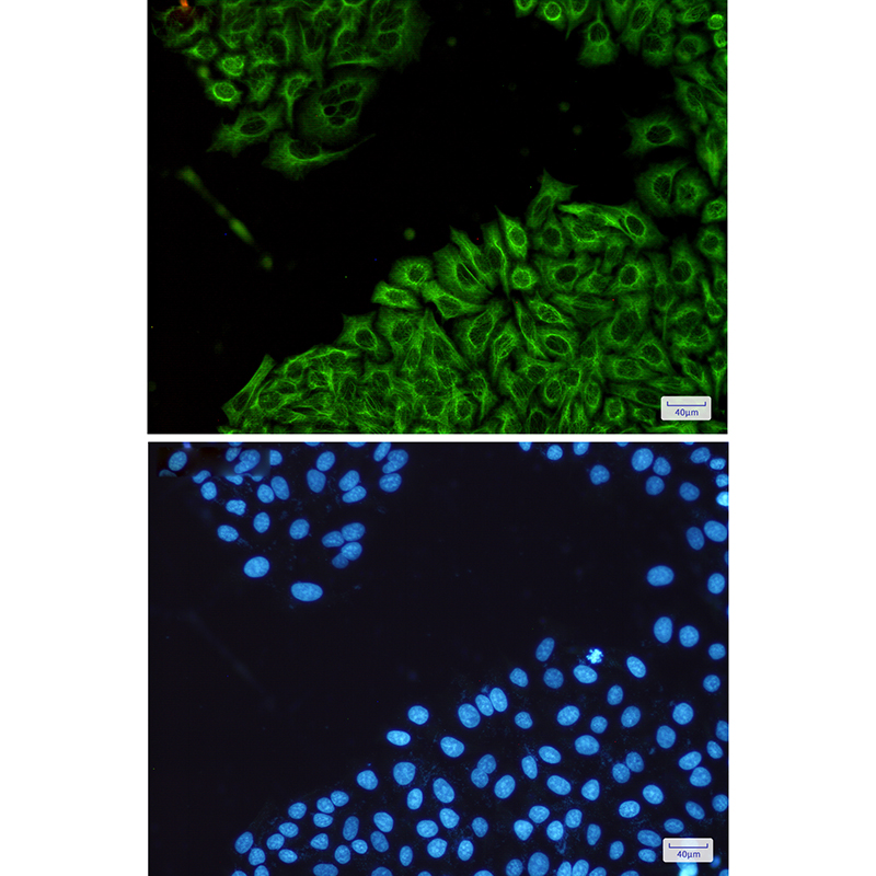 CK18 Rabbit mAb ABZ5245