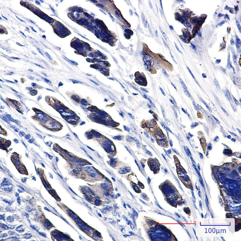 CK18 Rabbit mAb ABZ5245