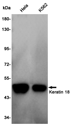 CK18 Rabbit mAb ABZ5245