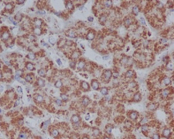 VDAC1/Porin Rabbit mAb ABZ5247