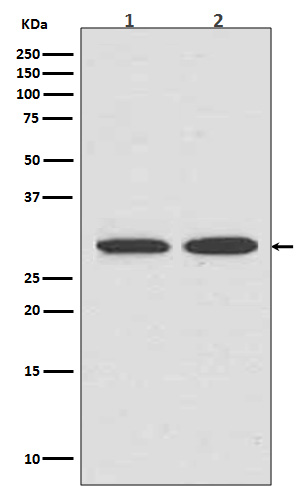 VDAC1/Porin Rabbit mAb ABZ5247