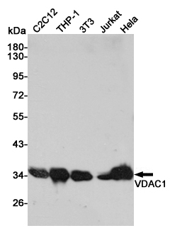 VDAC1/Porin Rabbit mAb ABZ5247