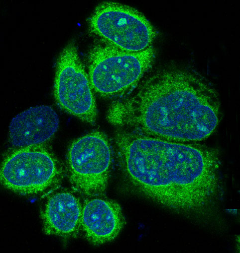 Alkaline Phosphatase Rabbit mAb ABZ5248