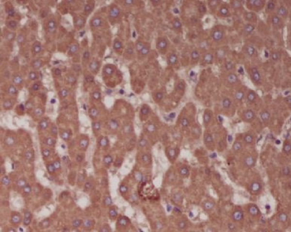 Alkaline Phosphatase Rabbit mAb ABZ5248