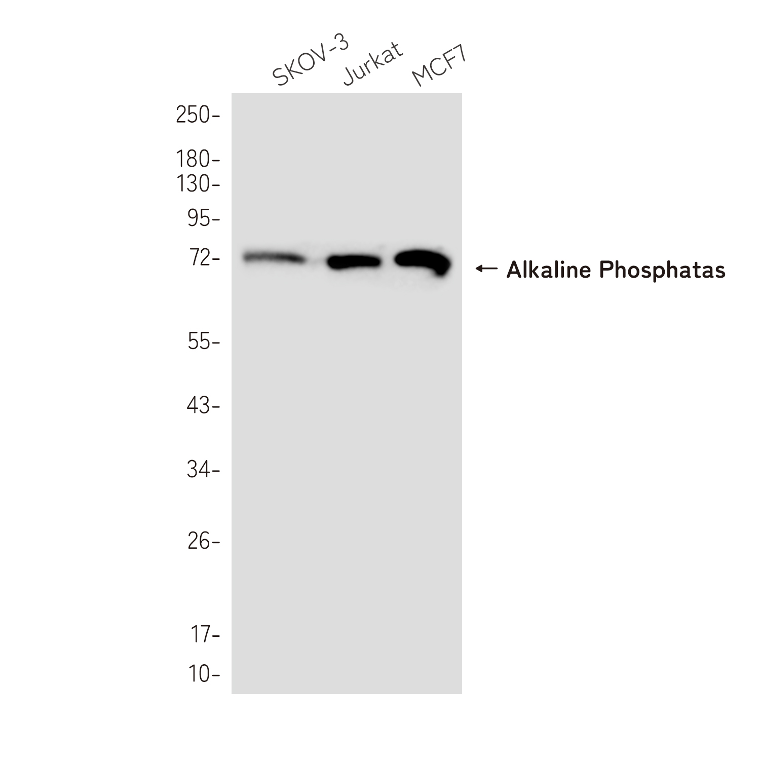 Alkaline Phosphatase Rabbit mAb ABZ5248