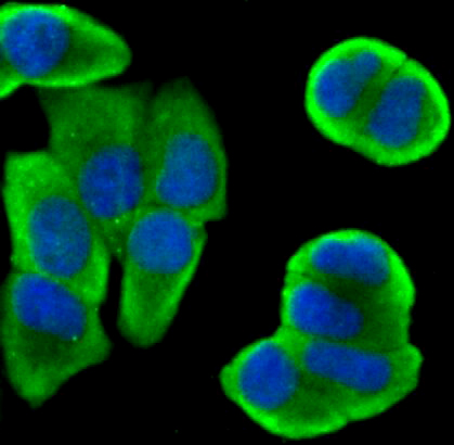 Bcl 2 Rabbit mAb ABZ5249