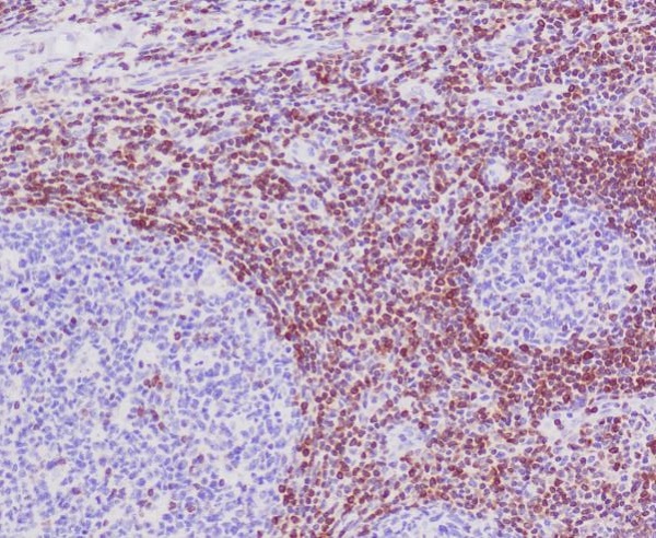 Bcl 2 Rabbit mAb ABZ5249