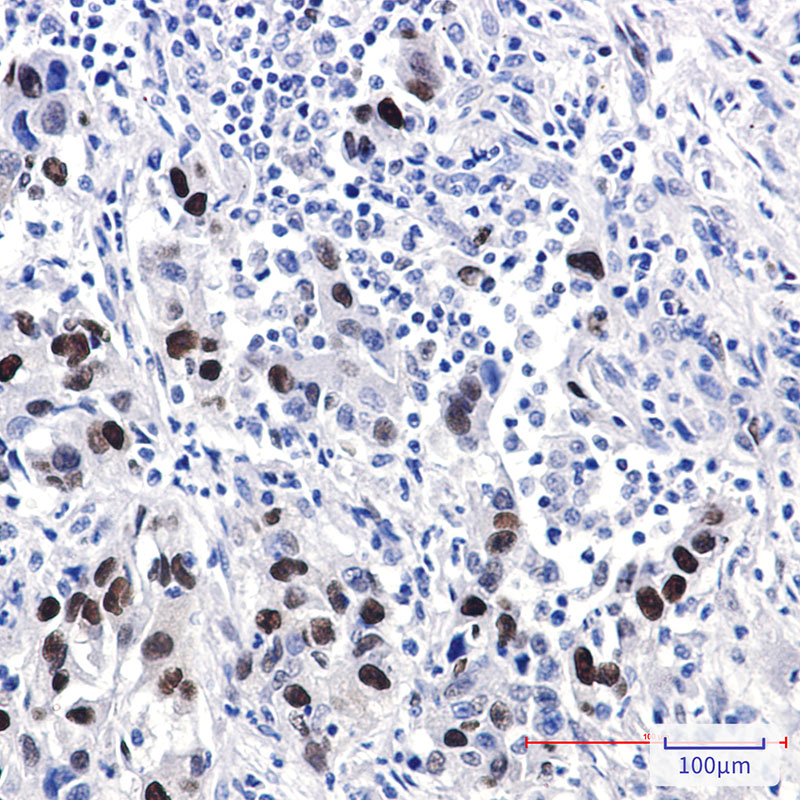 Cyclin D1 Rabbit mAb ABZ5250