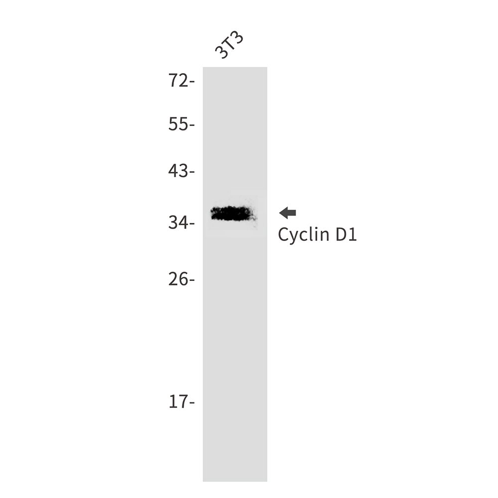 Cyclin D1 Rabbit mAb ABZ5250
