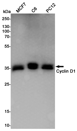 Cyclin D1 Rabbit mAb ABZ5250