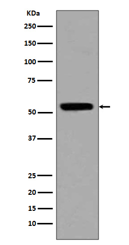 Acetyl-p53 (Lys370) Rabbit mAb ABZ5256