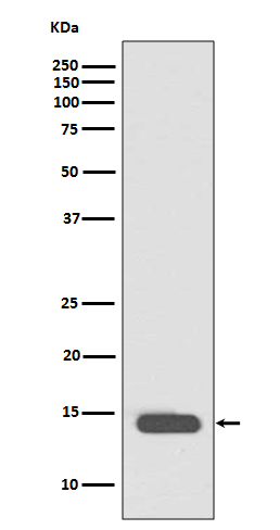 Acetyl-Histone H2B (Lys20) Rabbit mAb ABZ5257