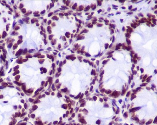 Hydroxyl-Histone H2A (Tyr39) Rabbit mAb ABZ5258