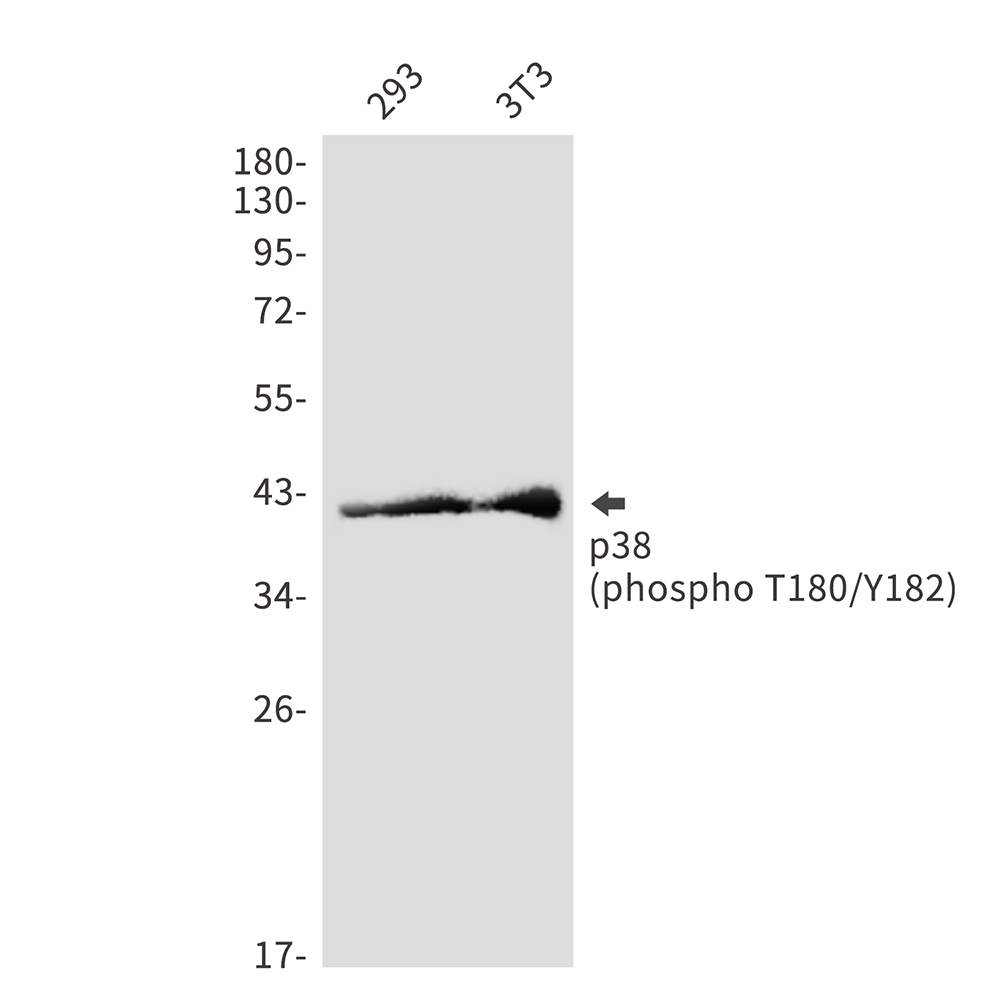 Phospho-p38 MAPK (Thr180/Tyr182) Rabbit mAb ABZ5259