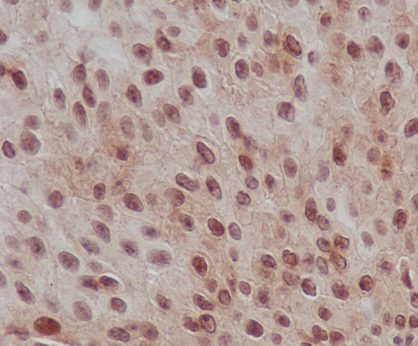 Phospho-Smad2 (Ser255) Rabbit mAb ABZ5260