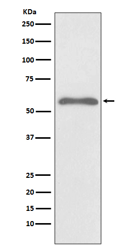Phospho-Smad2 (Ser255) Rabbit mAb ABZ5260