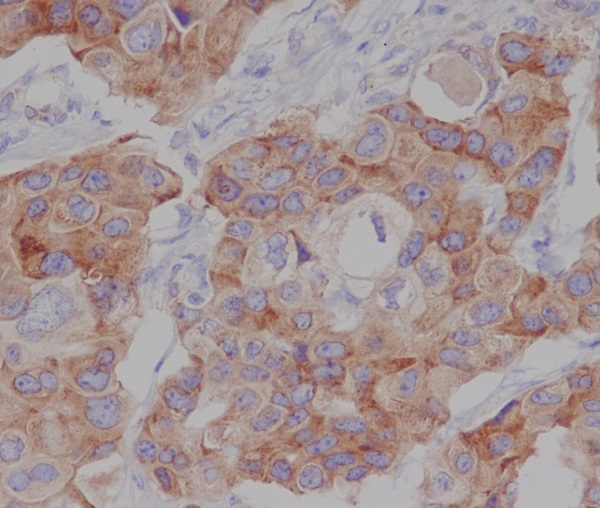 Phospho-mTOR (Ser2448) Rabbit mAb ABZ5264